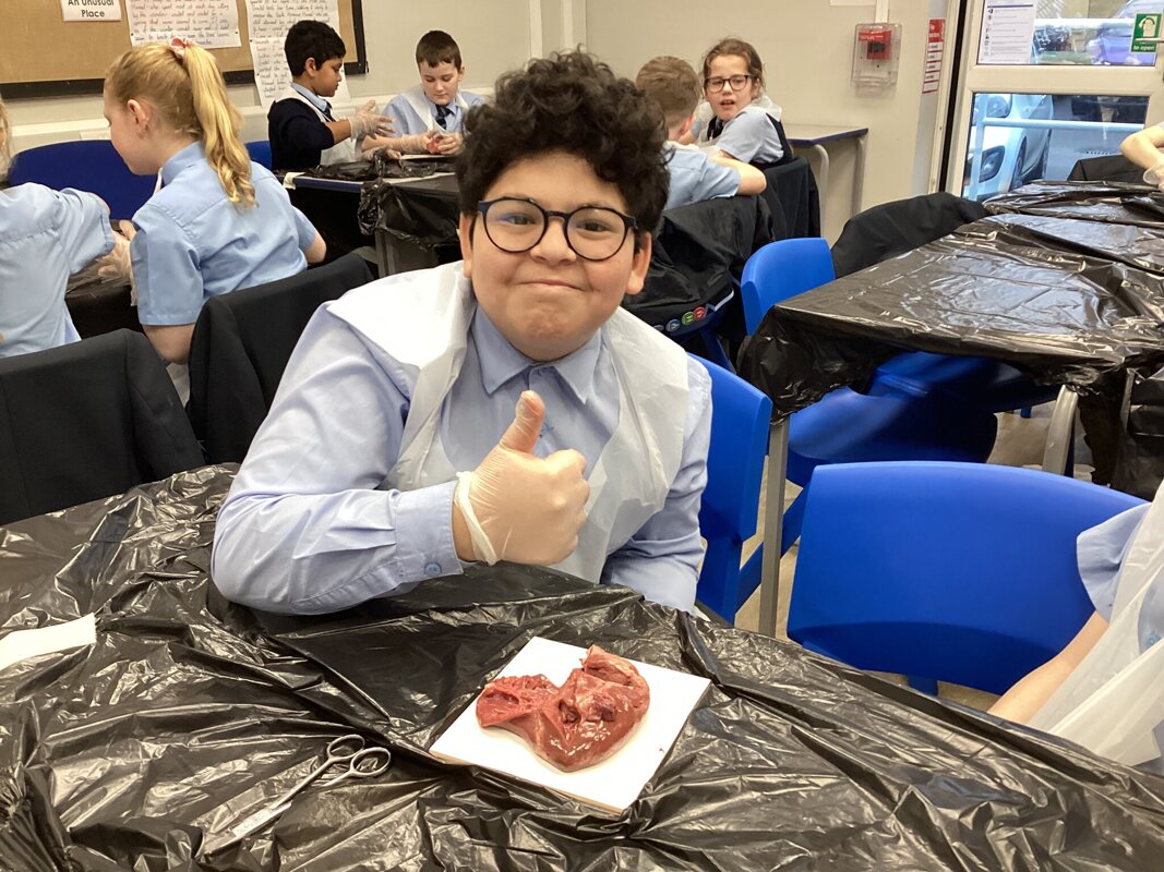 Image of Heart Dissection in Year 6 Science!